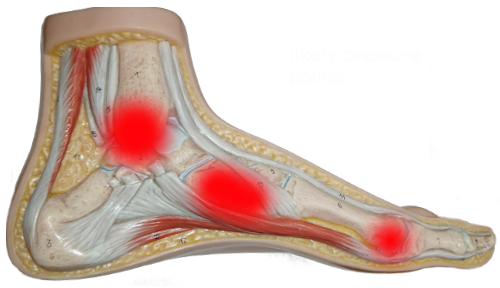likely pressure points