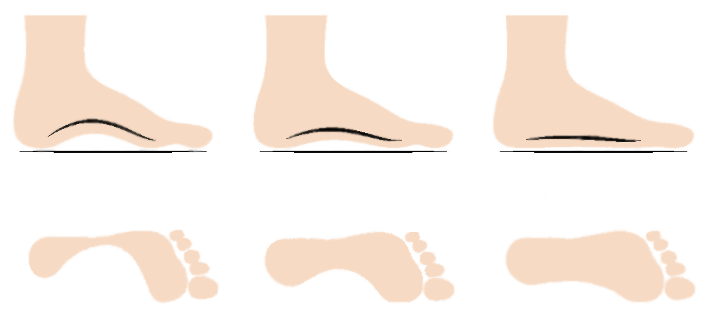 Fußtypen